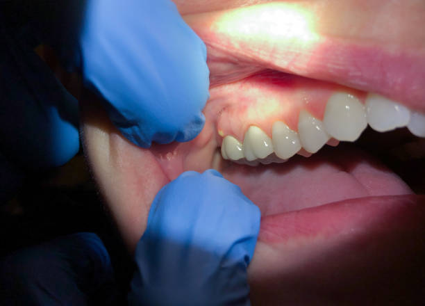 Best Emergency Dental Care for Trauma or Injury in North Branch, MI